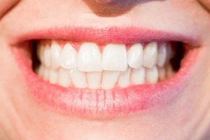 Dental Cleanings